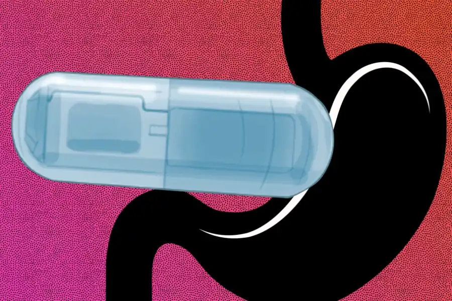 Tỉ lệ tử vong do tim mạch và đột quỵ ở người béo phì đang có xu hướng gia tăng nhanh chóng.